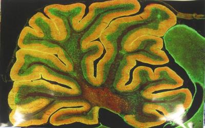 A Section of the Cerebellum That Has Been Fluorescently Labeled for the Ip3 Receptor