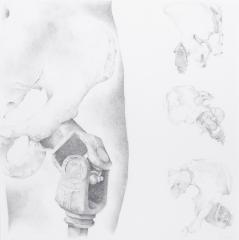 SCL Universal Hip Model (Non-meniscal Bearing)